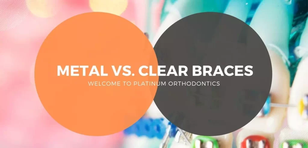 Metal vs. Clear Braces