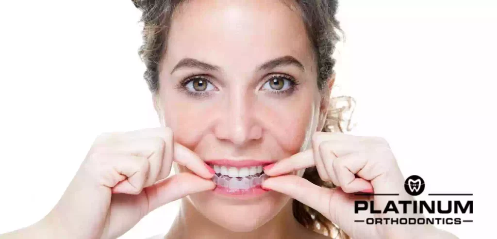 CLEAR (CERAMIC) BRACES