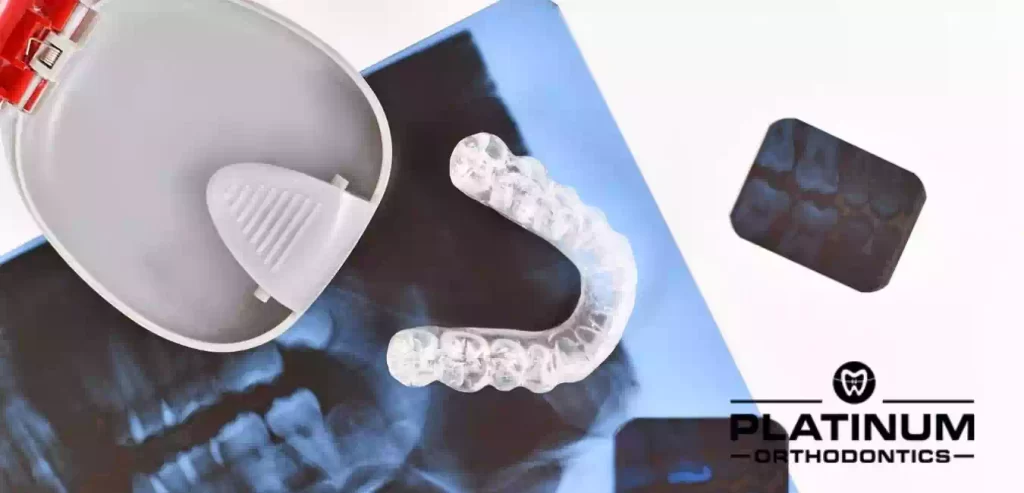 Retainer Instructions